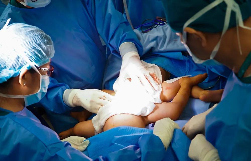 Nhìn lại hành trình tách rời cặp song sinh Trúc Nhi - Diệu Nhi ảnh 12 Nhìn lại hành trình tách rời cặp song sinh Trúc Nhi - Diệu Nhi ảnh 12