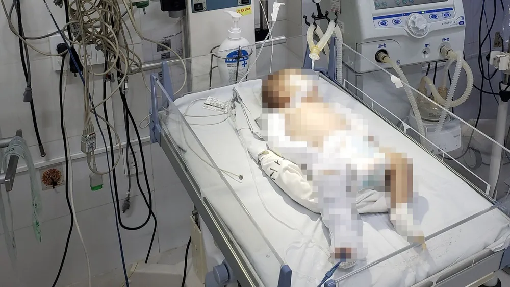 Cháu bé hơn 2 tháng tuổi bị bạo hành dã man. Ảnh: VTT Cháu bé hơn 2 tháng tuổi bị bạo hành dã man. Ảnh: VTT