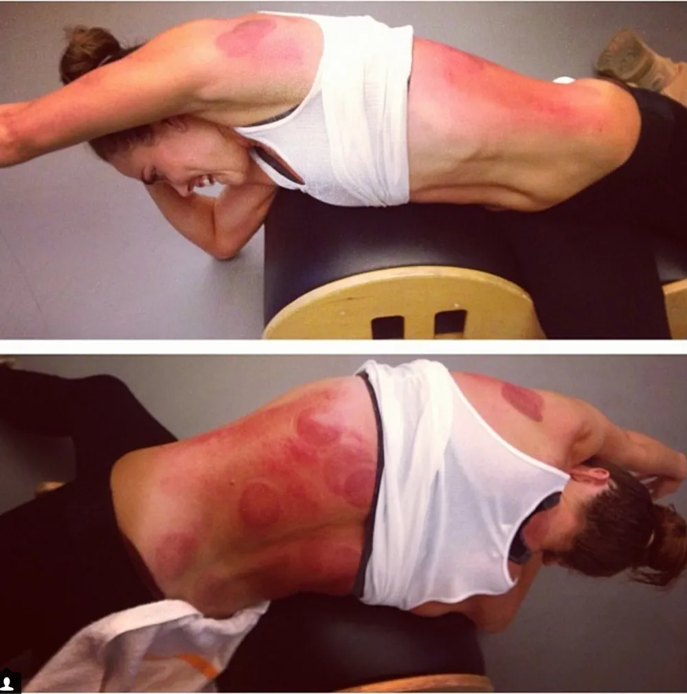 động viên bơi lội người Mỹ Natalie Coughlin