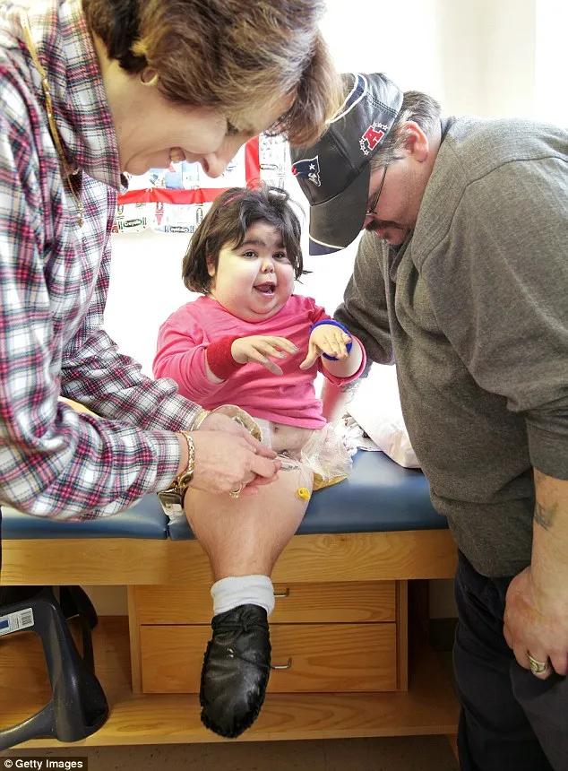 Thai nhi cũng không có bàng quang và có một lá gan còi cọc