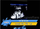 Buồn cười xem thai nhi song sinh “oánh nhau” trong bụng mẹ