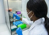 Đột biến mới khiến virus SARS-CoV-2 lây lan nhanh gấp 8 lần ảnh 2 WHO: Người khỏi COVID-19 tái nhiễm biến chủng SARS-CoV-2 mới