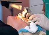 2 người mù thấy lại ánh sáng nhờ món quà từ cụ ông 83 tuổi ảnh 2 Có nên phẫu thuật chữa cận thị?