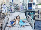 Đà Nẵng: Trẻ mắc bệnh tay chân miệng nhập viện tăng mạnh ảnh 2 Bé gái 15 tháng tuổi trụy tim do mắc tay chân miệng