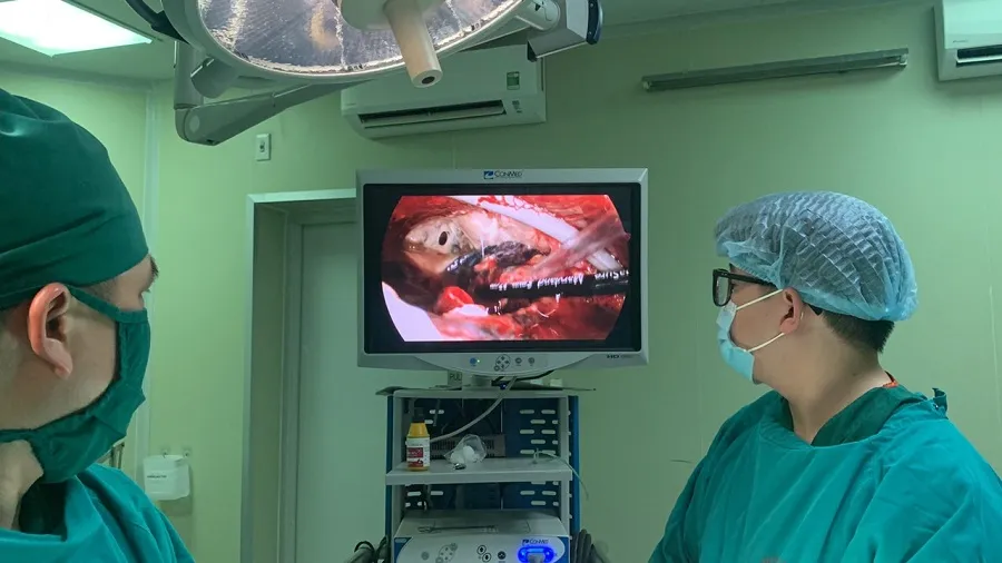 Các bác sĩ tiến hành phẫu thuật cho bệnh nhân. Ảnh: BVCC Các bác sĩ tiến hành phẫu thuật cho bệnh nhân. Ảnh: BVCC