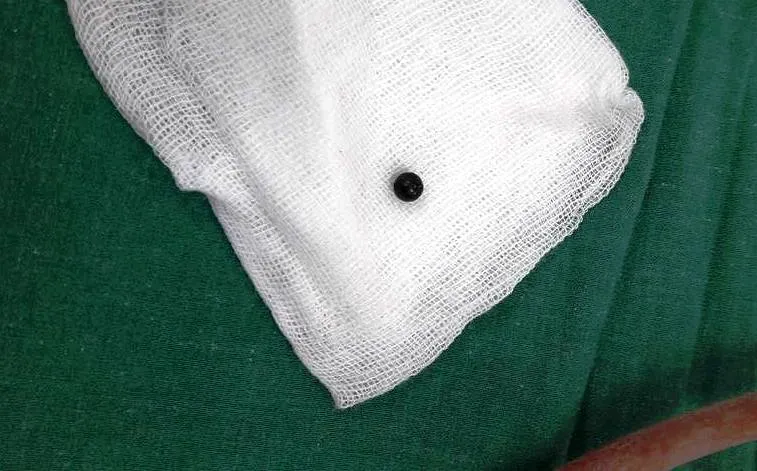 Bé 8 tuổi trúng đạn từ súng tự chế của hàng xóm ảnh 1