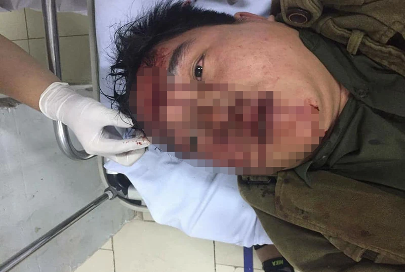 Đi theo bảo vệ thiếu nữ, nam thanh niên bị hành hung ảnh 1 Đi theo bảo vệ thiếu nữ, nam thanh niên bị hành hung ảnh 1