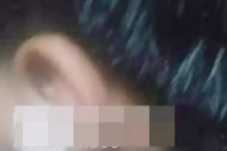 Hình ảnh em P. bị tổn thương vùng tai, người thân đăng lên mạng xã hội.