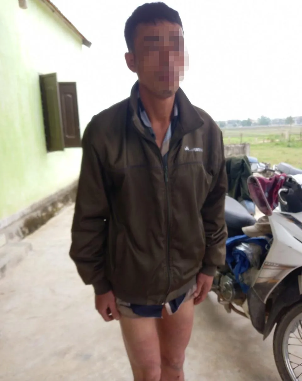 Anh Nguyễn Trọng Bang bị đánh bầm bắp chân. Ảnh gia đình cung cấp.