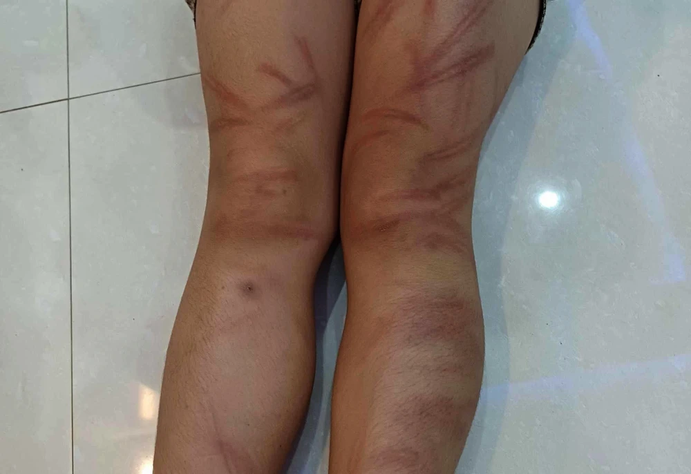 học sinh mầm non bị đánh