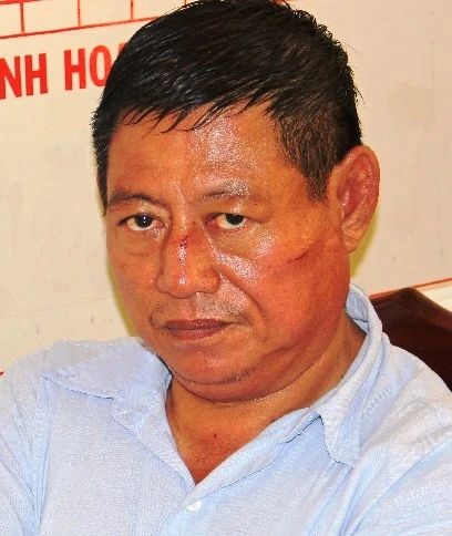 Lay Bun Thy (ảnh CTV CAAG)