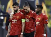 Manchester United lỗ nặng