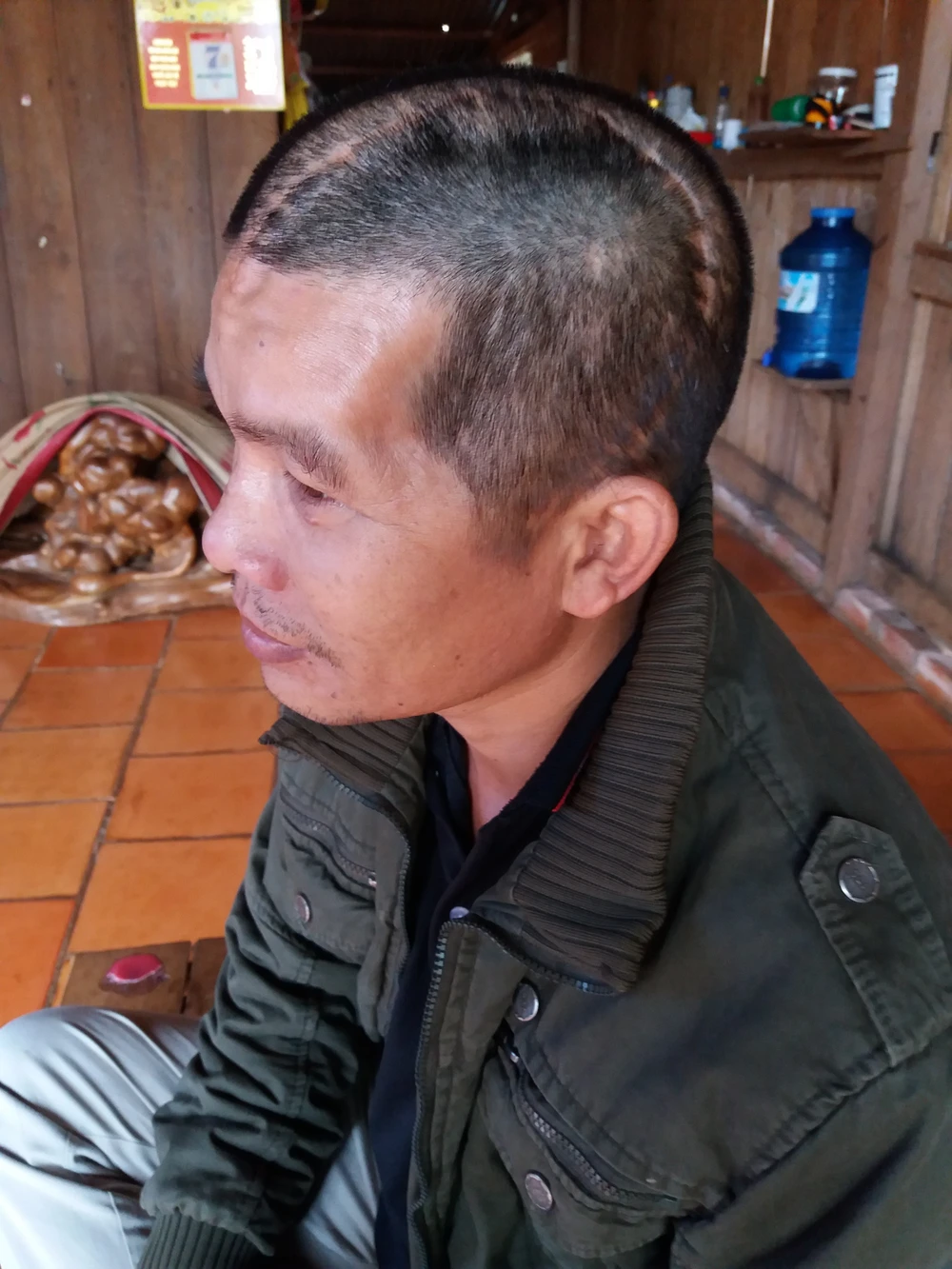 Ngày mai xử vụ nhóm bảo vệ Long Sơn truy sát người dân ảnh 1