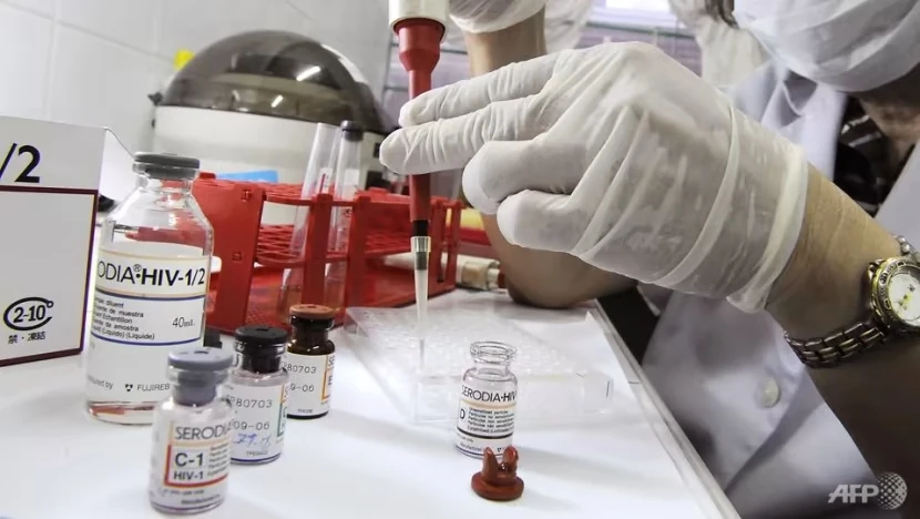 Kỹ thuật viên y tế đang xét nghiệm sàng lọc HIV. Ảnh: AFP Gian nan 40 năm tìm vaccine HIV