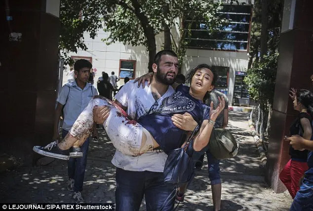 Chùm ảnh đau thương vụ đánh bom tự sát tại Thổ Nhĩ Kỳ ảnh 7