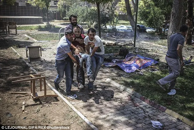 Chùm ảnh đau thương vụ đánh bom tự sát tại Thổ Nhĩ Kỳ ảnh 8