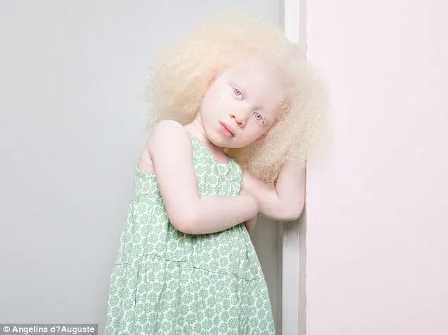 Vẻ đẹp mê hoặc của những người bị bạch tạng ảnh 10