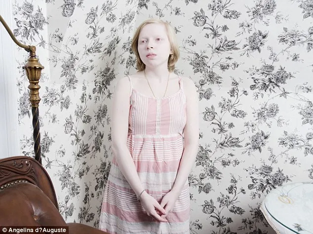 Vẻ đẹp mê hoặc của những người bị bạch tạng ảnh 11