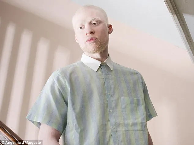 Vẻ đẹp mê hoặc của những người bị bạch tạng ảnh 12