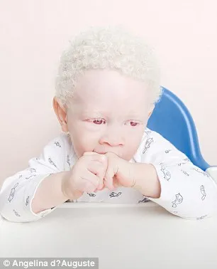 Vẻ đẹp mê hoặc của những người bị bạch tạng ảnh 4