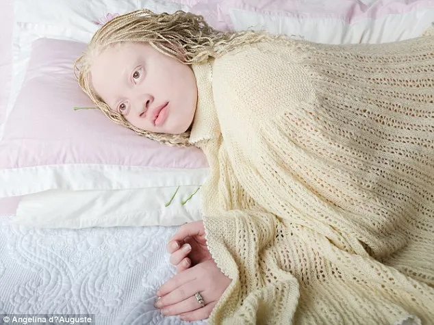 Vẻ đẹp mê hoặc của những người bị bạch tạng ảnh 5