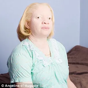 Vẻ đẹp mê hoặc của những người bị bạch tạng ảnh 6