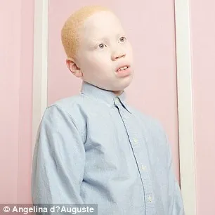 Vẻ đẹp mê hoặc của những người bị bạch tạng ảnh 7