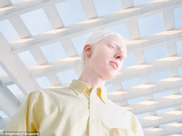 Vẻ đẹp mê hoặc của những người bị bạch tạng ảnh 9