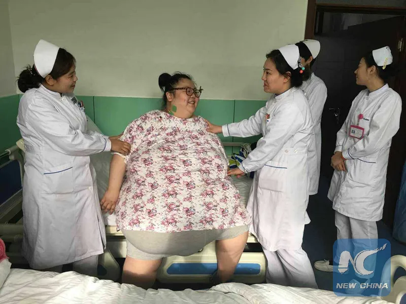 Người phụ nữ nặng 224 kg được phẫu thuật giảm béo thành công ảnh 1