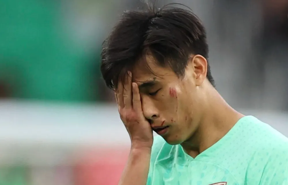 la-lung-trong-tai-asain-cup-khong-phat-cau-thu-da-xuoc-mat-dong-nghiep (3).jpg