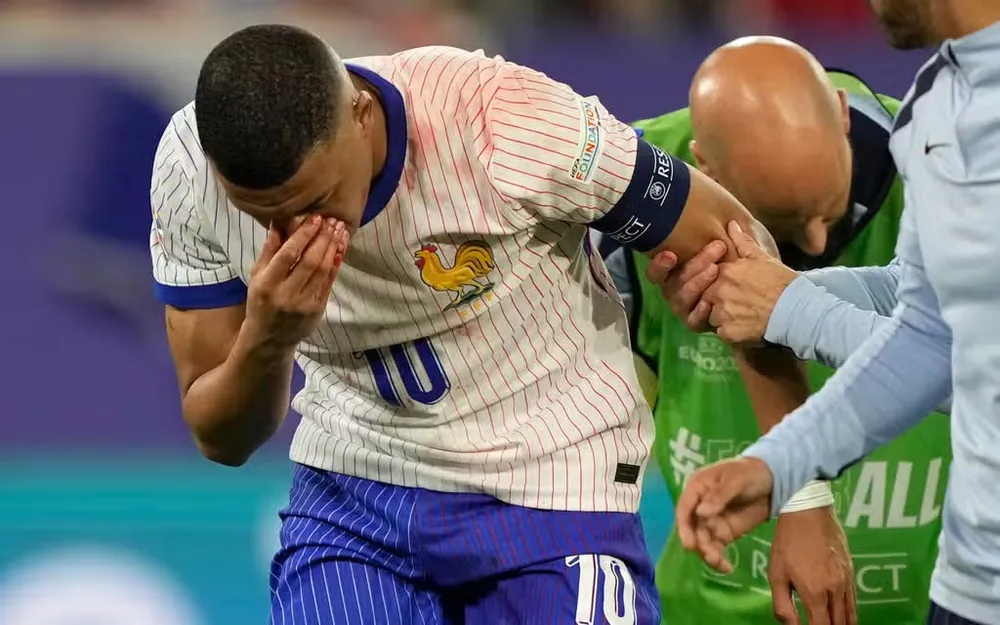 Đội tuyển Pháp đang rất lo lắng cho cái mũi bị gãy của Mbappe. Ảnh: GETTY. mbappe-roi-san-voi-cai-mui-day-mau-doi-tuyen-phap-thiet-hai-nang-ne (3).jpg