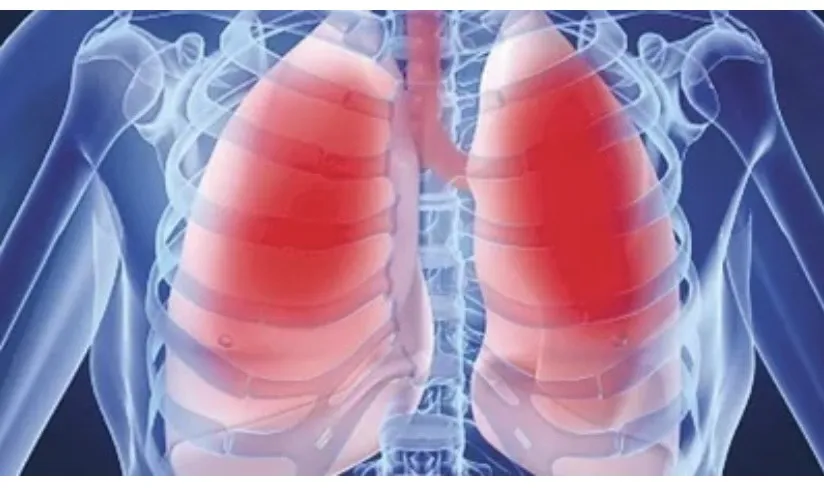 Việc bỏ hút thuốc lá là một hành trình nan giải nhưng thành công nó không chỉ cải thiện sức khỏe tổng thể mà còn tăng cường sức khỏe cho phổi của bạn. Ảnh: Representative image. Lời khuyên cho người đang bỏ hút thuốc lá và cách tăng cường sức khỏe phổi.jpg