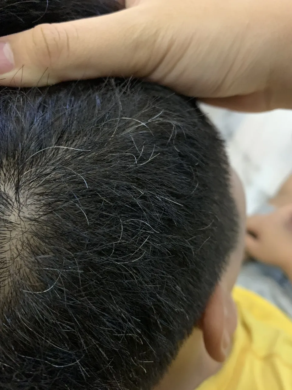 Tóc bạc sớm là nguyên nhân khiến nhiều người lo lắng và có thể ngăn ngừa tình trạng đó bằng cách bổ sung những thực phẩm này vào chế độ ăn uống của mình. Ảnh: PHƯƠNG LÊ Giảm tình trạng tóc bạc sớm với 5 siêu thực phẩm này.jpg