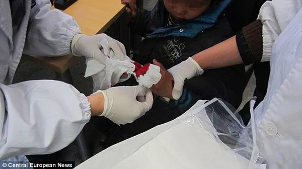 Lên cơn giận bố, mẹ chặt phăng 3 ngón tay con trai 8 tuổi 1 Lên cơn giận bố, mẹ chặt phăng 3 ngón tay con trai 8 tuổi 1