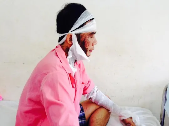 Anh Minh bị tạt axit khi vừa ra khỏi công ty Anh Minh bị tạt axit khi vừa ra khỏi công ty