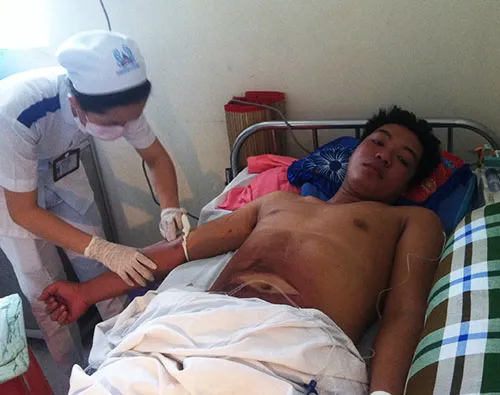 Sang tỉnh táo, ngoài hai bàn chân bị tổn thương do "cáp đông", các vị trí khác trên cơ thể anh đều không bị ảnh hưởng nghiêm trọng. Ảnh:Thiên Chương. tai-xe-JPG-5162-1406280544.jpg