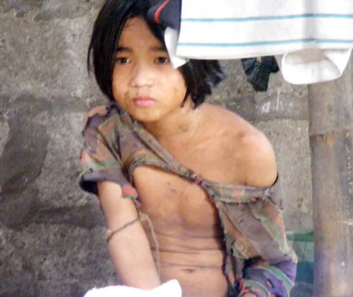 Mẹ con em bé ‘người rừng’