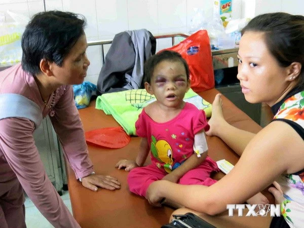 Biểu dương hai vợ chồng giải cứu bé gái 4 tuổi bị bạo hành ảnh 1