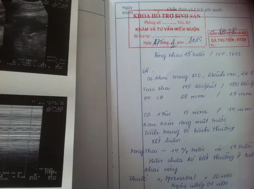 Kỳ diệu vợ mang thai từ người chồng không có tinh trùng ảnh 2 - 2