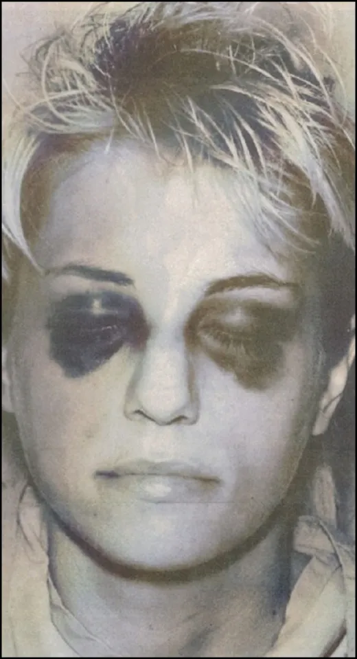 Những bức ảnh tội phạm từng gây chấn động nhất thế giới ảnh 4 Những bức ảnh tội phạm từng gây chấn động nhất thế giới ảnh 4