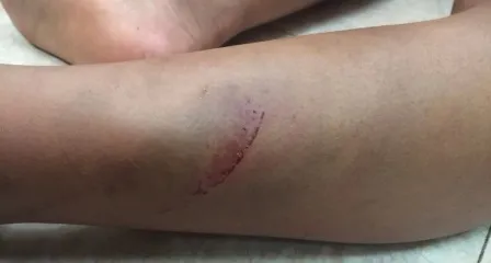 bé trai; bị bạo hành; đánh đập; Lục Ngạn; Bắc Giang bé trai; bị bạo hành; đánh đập; Lục Ngạn; Bắc Giang