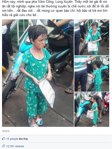 Sự thật câu chuyện bé gái 'bị tạt nước sôi gây lở loét để bắt đi ăn xin' ảnh 1