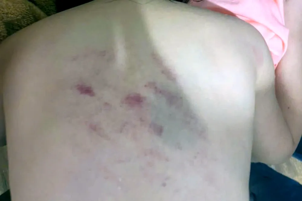 Thanh Hóa Đình chỉ công tác cô giáo có hành vi bạo lực với học sinh - 2.jpg