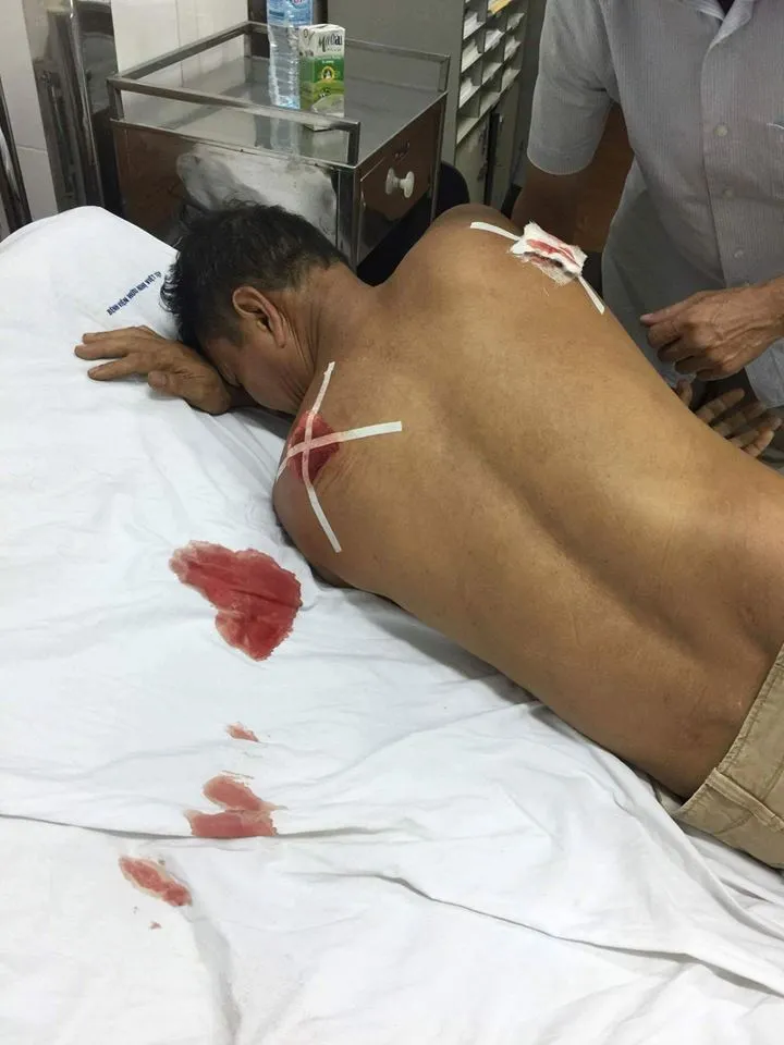 Ông Lưu khi được đưa vào bệnh viện