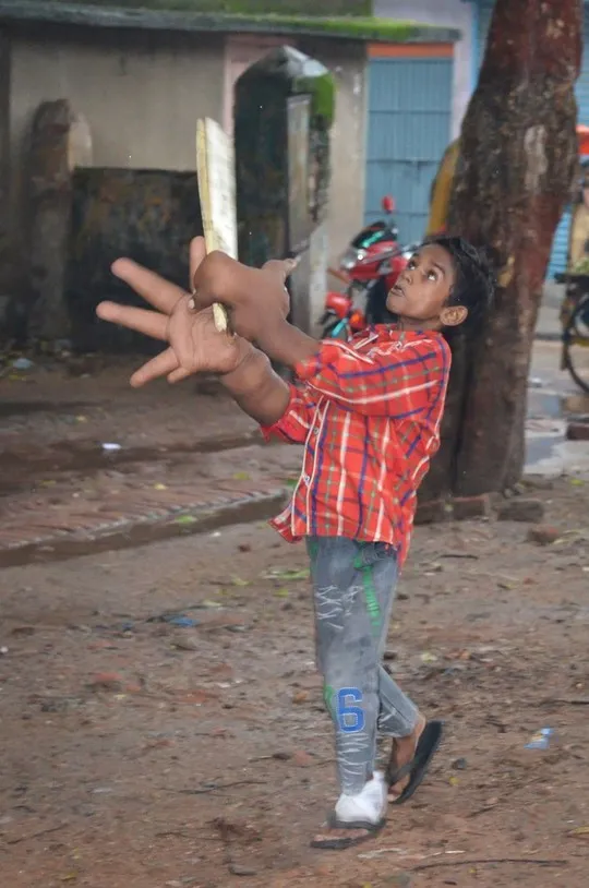 Nhiều khả năng cậu bé đã mắc bệnh u mạch bạch huyết hoặc bệnh u mô thừa