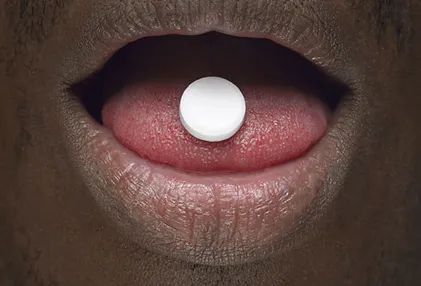 Nhìn răng miệng, chẩn bệnh ảnh 2