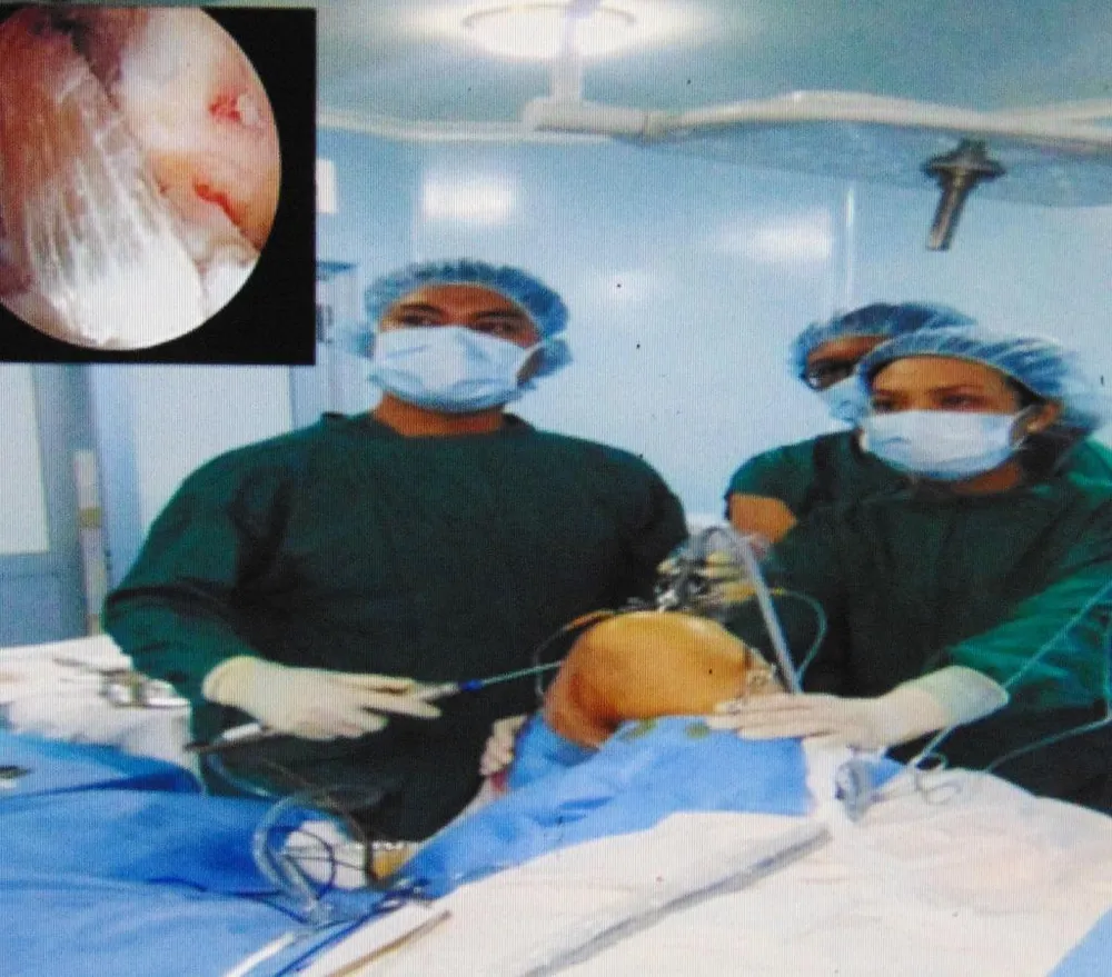 BV củ chi phẫu thuật nội soi