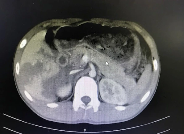 Bác sĩ 5 khoa của BV hợp lực cứu nạn nhân đa vết thương ảnh 1