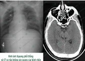 Cứu sống ngoạn mục người đàn ông ngã từ độ cao 6m ảnh 2 Tài xế hôn mê sâu khi lái xe chỉ vì quên ăn sáng