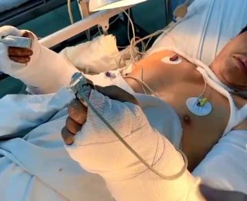 Hai tay ông H sau khi được khâu nối. Ảnh: BVCC